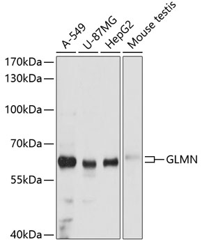 Western blot analysis of extracts of various cell lines, using GLMN antibody  at 1:3000 dilution