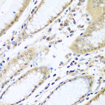 a07320 wdr48 primary antiboties ihc testing 3