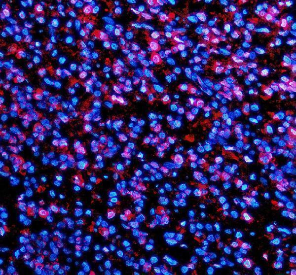 a07322 1 tmc6 primary antibodies if testing 1