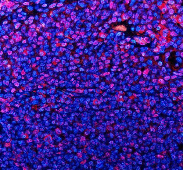 a07322 1 tmc6 primary antibodies if testing 2