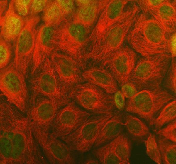 a07322 1 tmc6 primary antibodies if testing 3