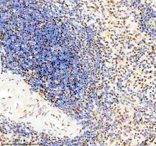 IHC analysis of TMC6 using anti-TMC6 antibody (A07322-1)