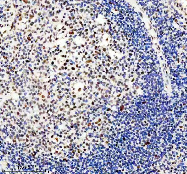 IHC analysis of TMC6 using anti-TMC6 antibody (A07322-1)