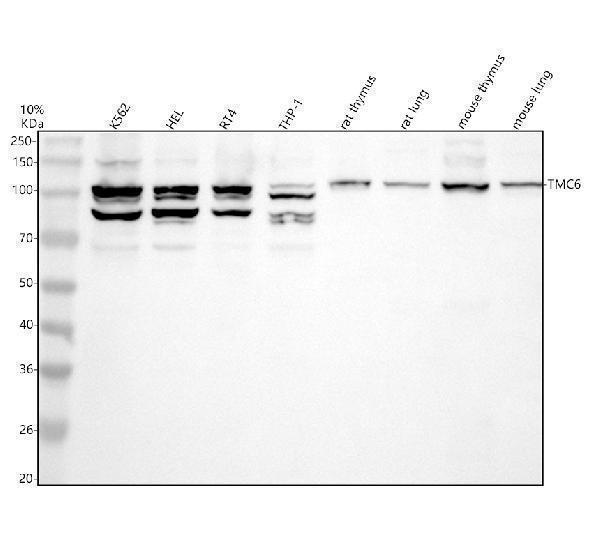 Western blot analysis of TMC6 using anti-TMC6 antibody (A07322-1)