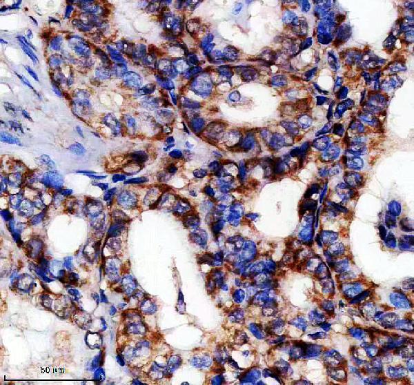 IHC analysis of ENOSF1 using anti-ENOSF1 antibody (A07325-2)