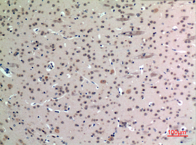 a07326 fgf12 primary antibodies ihc testing 1