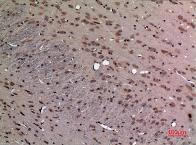 a07326 fgf12 primary antibodies ihc testing 4