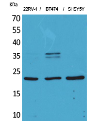 a07326 fgf12 primary antibodies wb testing 2