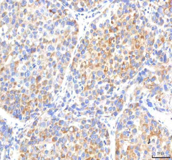  IHC analysis of IPO8 using anti-IPO8 antibody (A07327-2)
