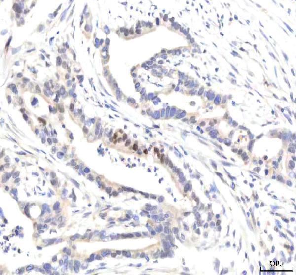  IHC analysis of IPO8 using anti-IPO8 antibody (A07327-2)
