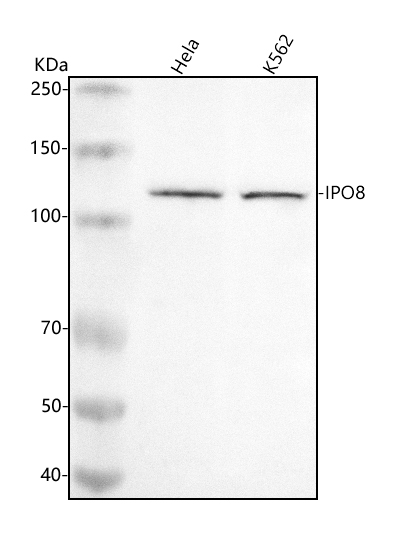  Western blot analysis of IPO8 using anti-IPO8 antibody (A07327-2)