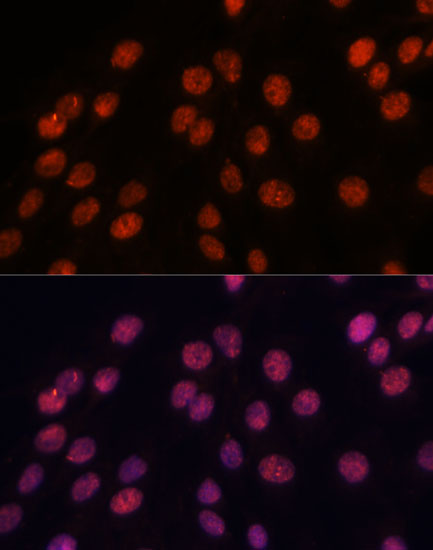 Immunofluorescence analysis of C6 cells using IPO8 antibody  at dilution of 1:100