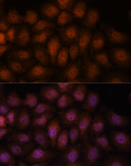 Immunofluorescence analysis of HeLa cells using IPO8 antibody  at dilution of 1:100