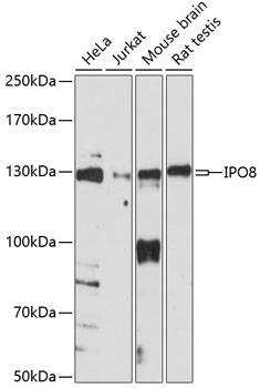 Western blot analysis of extracts of various cell lines, using IPO8 antibody  at 1:1000 dilution