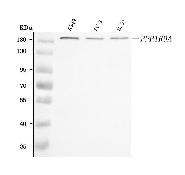  Western blot analysis of PPP1R9A using anti-PPP1R9A antibody (A07331-1)