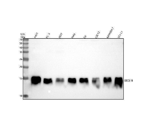  Western blot analysis of SEC61B using anti-SEC61B antibody (A07334-2)