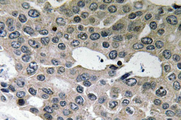 a07336 bnip2 primary antibodies ihc testing 1