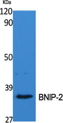 a07336 bnip2 primary antibodies wb testing 2