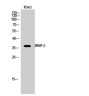 a07336 bnip2 primary antibodies wb testing 3