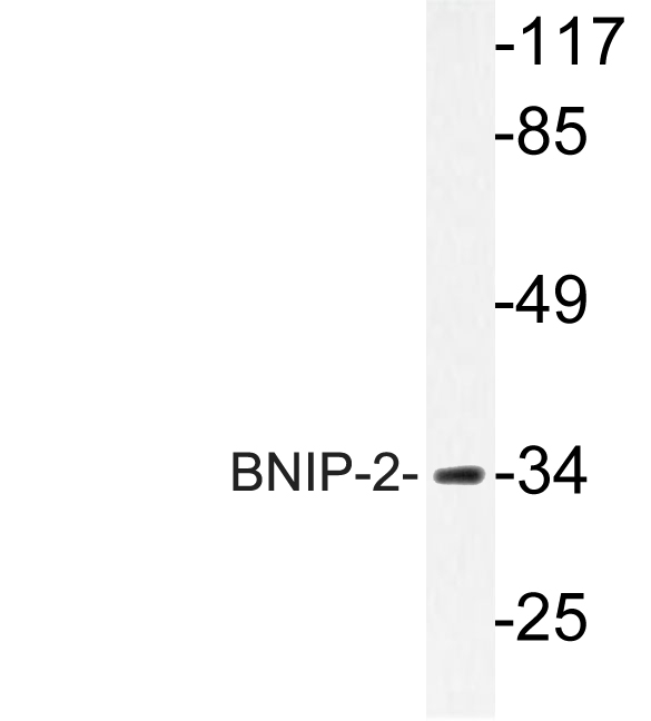 a07336 bnip2 primary antibodies wb testing 4