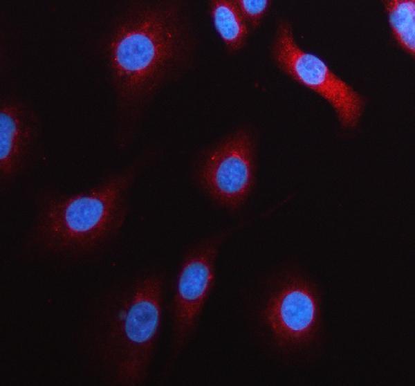 a07337 2 pfkp primary antibodies if testing 1