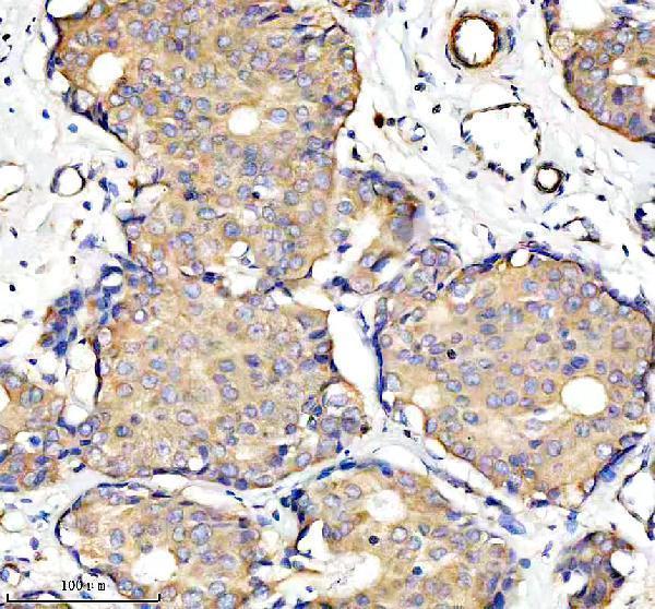 a07337 2 pfkp primary antibodies ihc testing 2