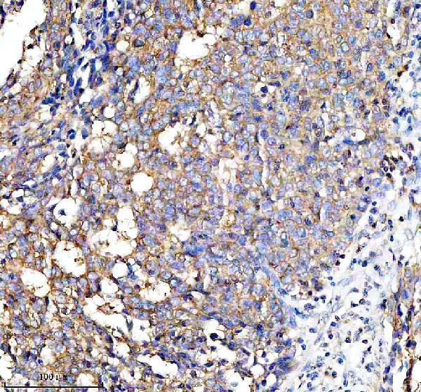 a07337 2 pfkp primary antibodies ihc testing 3