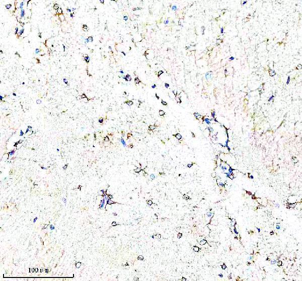 a07337 2 pfkp primary antibodies ihc testing 4