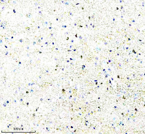 a07337 2 pfkp primary antibodies ihc testing 5