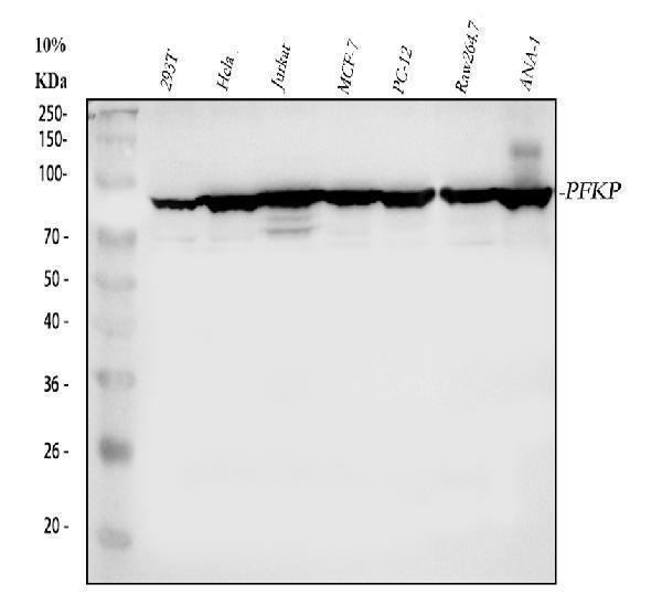 a07337 2 pfkp primary antibodies wb testing 1