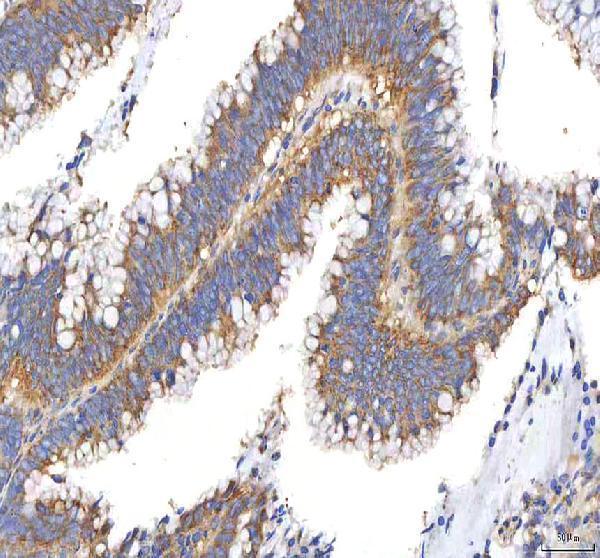  IHC analysis of PFKP using anti-PFKP antibody (A07337-3)