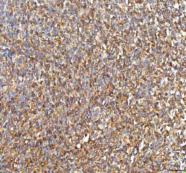  IHC analysis of PFKP using anti-PFKP antibody (A07337-3)