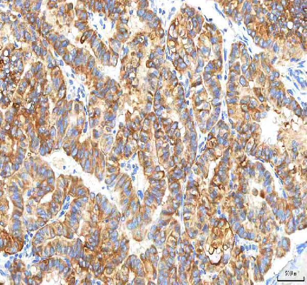 a07337 3 pfkp primary antibodies ihc testing 4