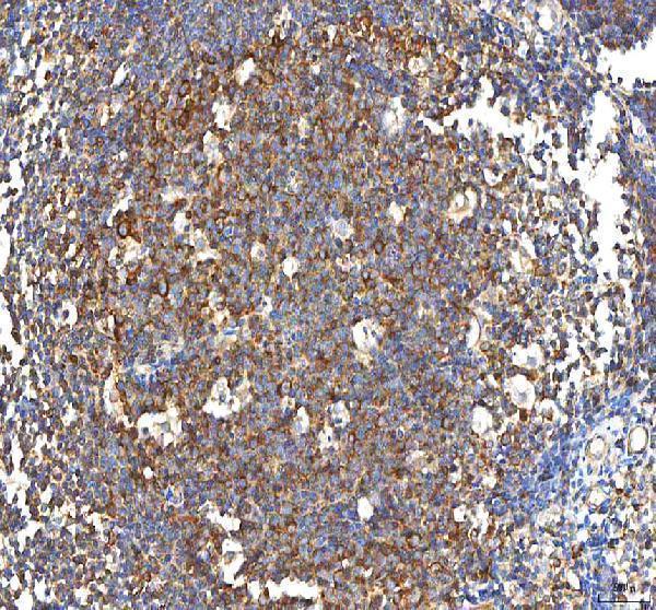 a07337 3 pfkp primary antibodies ihc testing 5