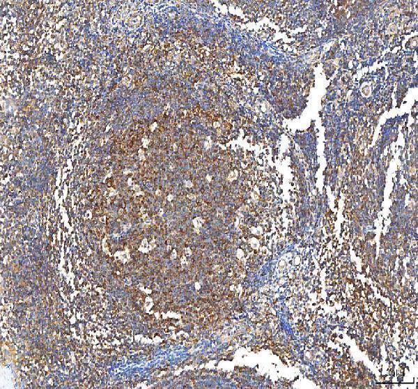 a07337 3 pfkp primary antibodies ihc testing 6