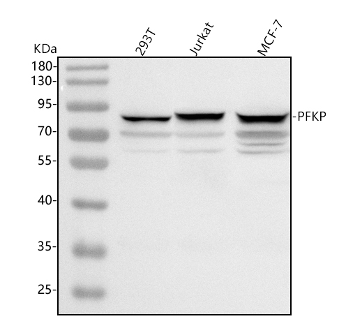  Western blot analysis of PFKP using anti-PFKP antibody (A07337-3)