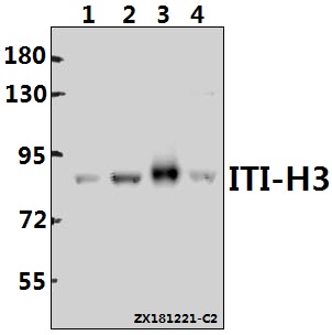 Western blot (WB) analysis of ITI-H3 (D651) polyclonal antibody at 1:500 dilution
Lane1:HEK293T whole cell lysate(40ug)
Lane2:H1792 whole cell lysate(40ug)
Lane3:H9C2 whole cell lysate(40ug)
Lane4:AML-12 whole cell lysate(40ug)
