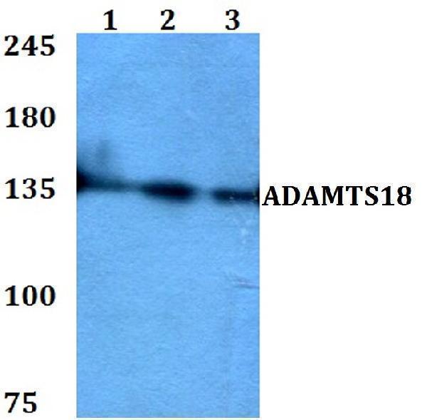 Western blot (WB) analysis of ADAMTS18 polyclonal antibody at 1:500 dilution
Lane1:HEK293T whole cell lysate
Lane2:Raw264