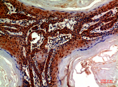 Immunohistochemical analysis of paraffin-embedded human-skin, antibody was diluted at 1:200