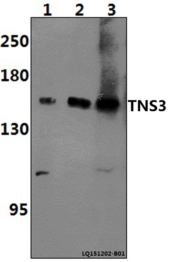 Western blot (WB) analysis of TNS3 polyclonal antibody at 1:500 dilution
Lane1:H9C2 whole cell lysate(40ug)
Lane2:NIH-3T3 whole cell lysate(40ug)
Lane3:DLD whole cell lysate(40ug)
