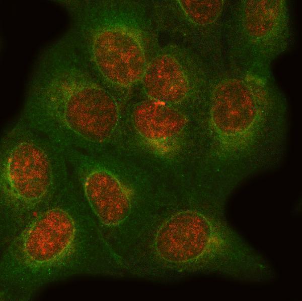 a07349 onecut1 primary antibodies if testing 2