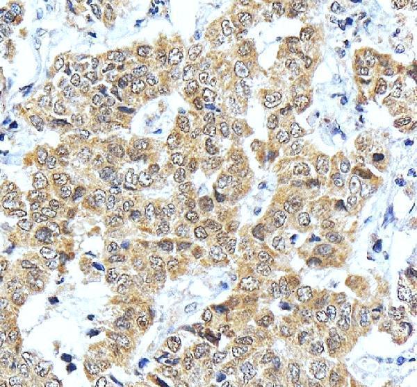 IHC analysis of ONECUT1 using anti-ONECUT1 antibody (A07349)