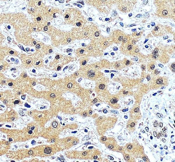 IHC analysis of ONECUT1 using anti-ONECUT1 antibody (A07349)