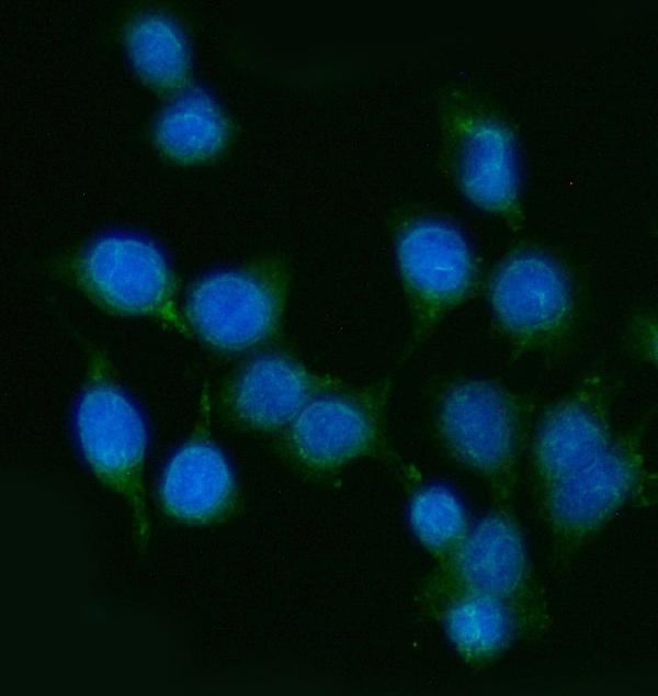 a07350 1 endou primary antibodies if testing 4