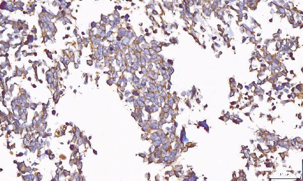  IHC analysis of PP11/ENDOU using anti-PP11/ENDOU antibody (A07350-1)
