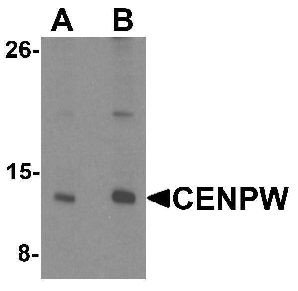 Western blot analysis of CENPW in HeLa cell lysate lysate with CENPW antibody at (A) 0