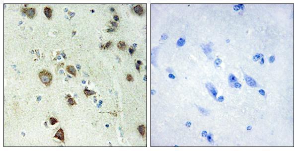 Immunohistochemistry analysis of paraffin-embedded human brain tissue, using S6K-alpha6 Antibody