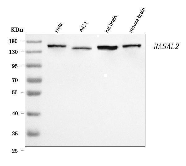  Western blot analysis of RASAL2 using anti-RASAL2 antibody (A07356-1)