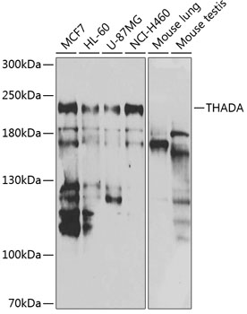 a07358 thada primary antiboties wb testing 1
