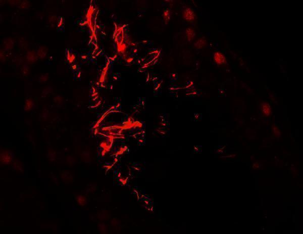 a07362 akap4 primary antibodies if testing 3